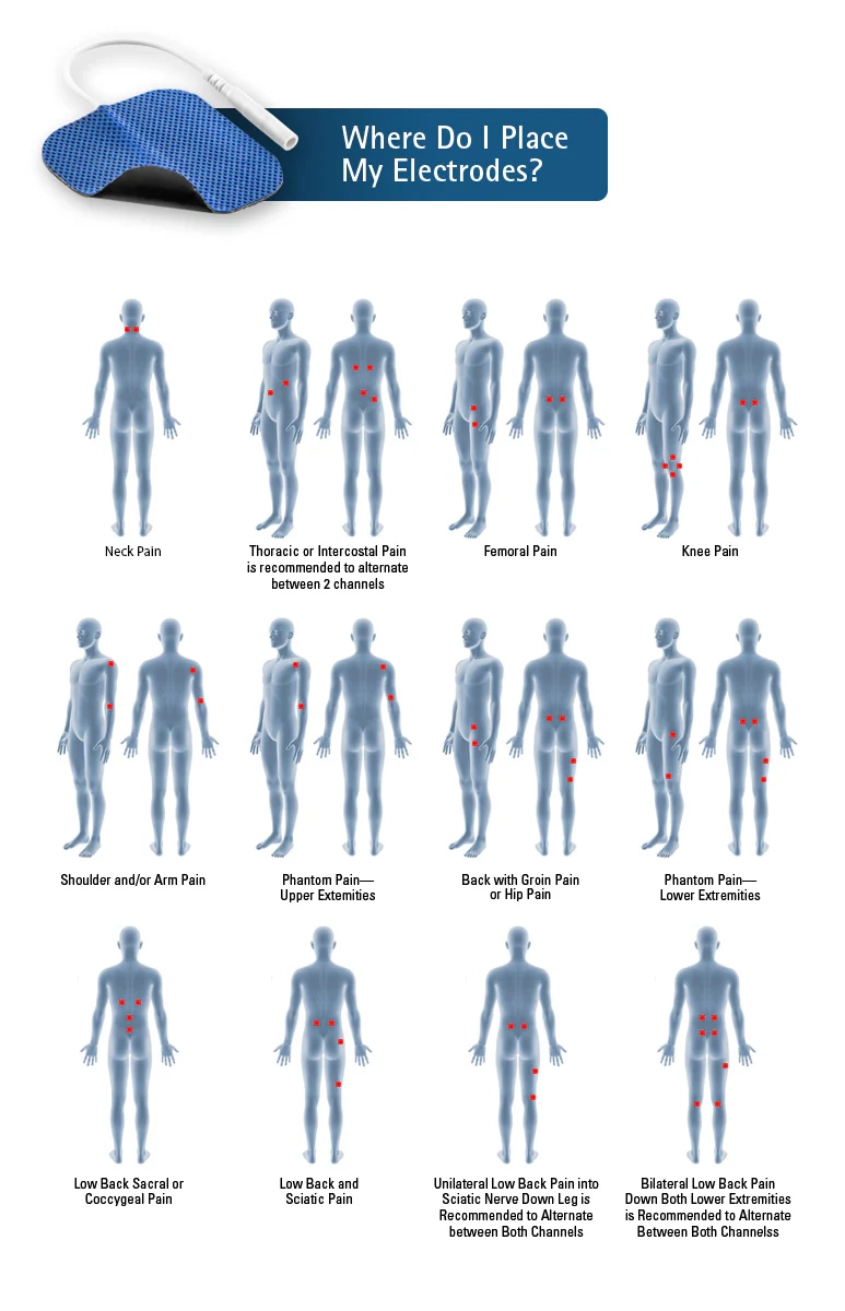 Electrode Placement Electrode Placement