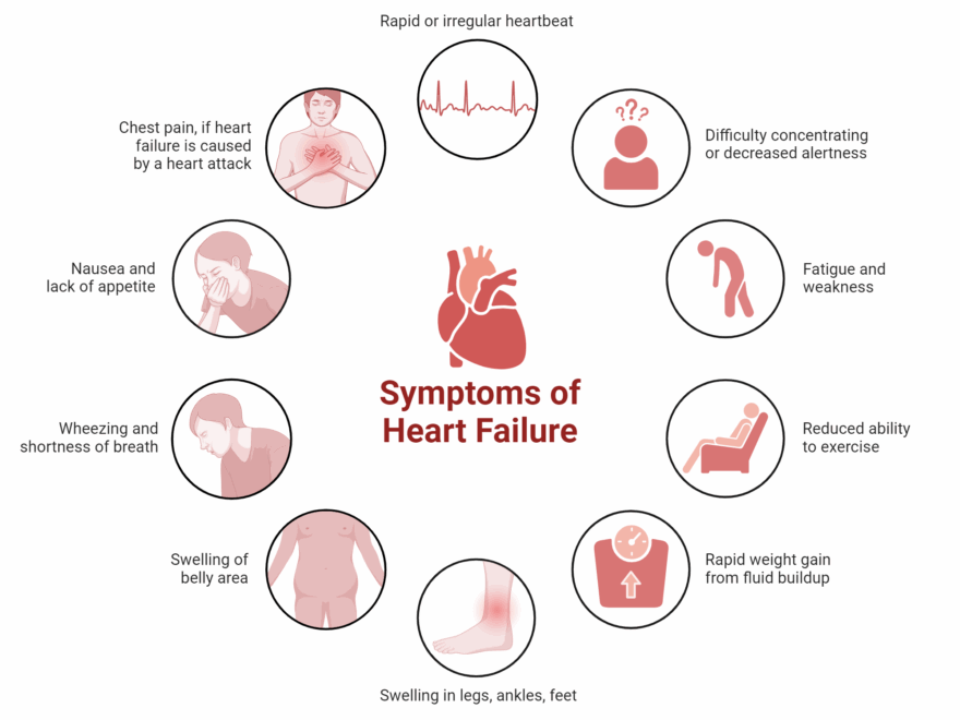 Symptoms Of Heart Failure BioRender Science Templates