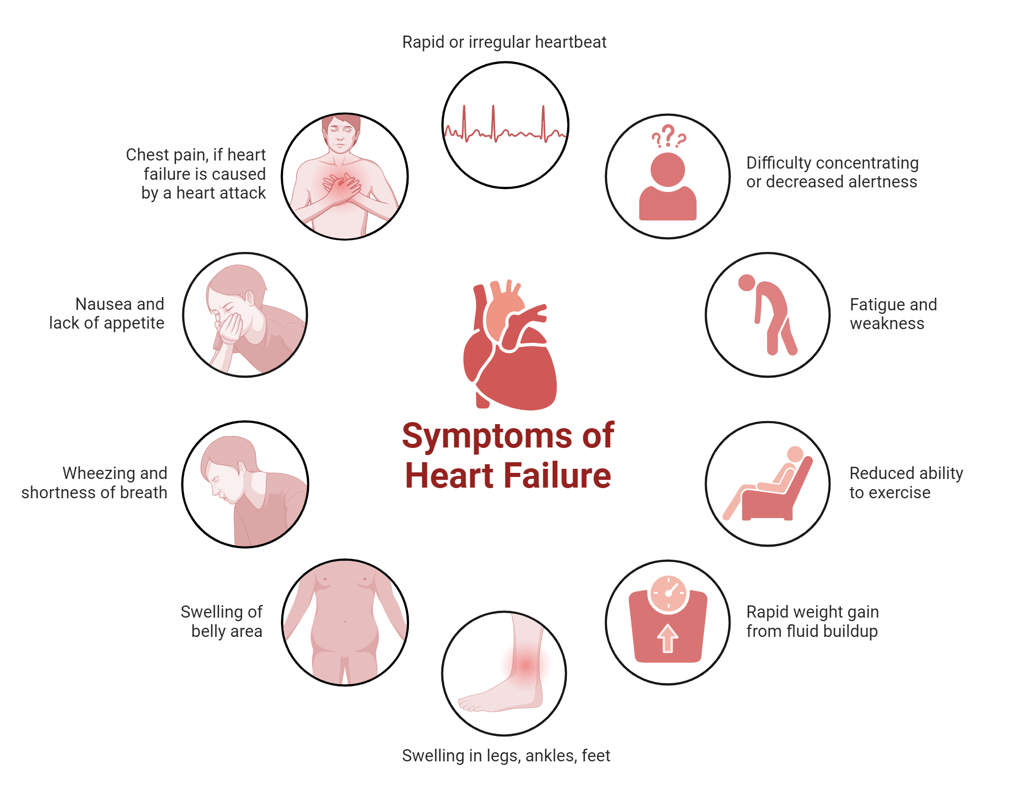 Symptoms Of Heart Failure BioRender Science Templates