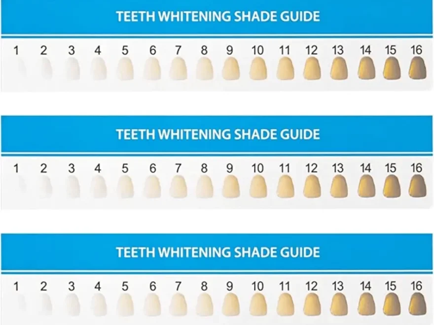Teeth Whitening Shade Guide Download Printable PDF Templateroller