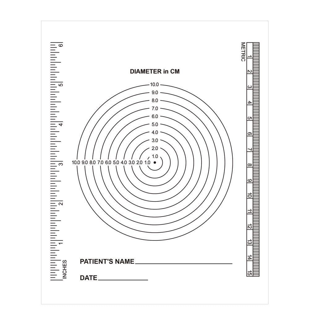 Wound Measuring Guide Printable Wound Measuring Guide Printable